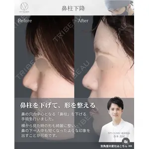 吉祥寺アイビークリニック 升本 浩紀医師の症例