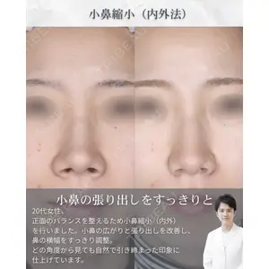 吉祥寺アイビークリニック 升本 浩紀医師の症例
