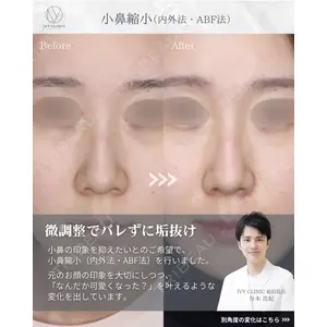 吉祥寺アイビークリニック 升本 浩紀医師の症例