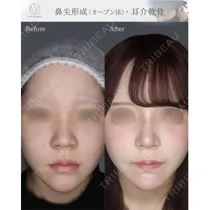 吉祥寺アイビークリニック 升本 浩紀医師の症例