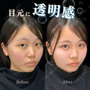 CROWN BEAUTY CLINIC 神山 豊医師の症例