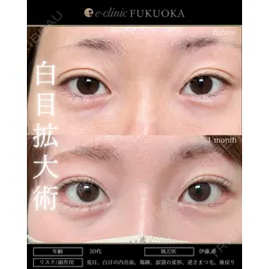 eクリニック 福岡院 伊藤 渉医師の症例