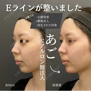 ロレシー美容クリニック 心斎橋駅前院 福留院長医師の症例