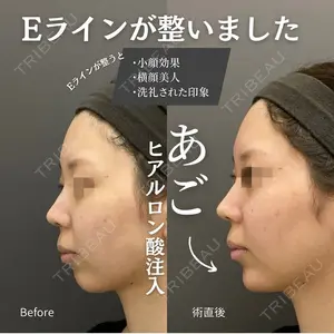 ロレシー美容クリニック 心斎橋駅前院 福留院長医師の症例