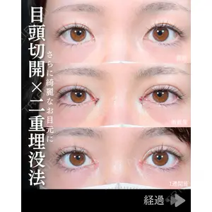 東京シンデレラ美容外科 池袋院 石井 達也医師の症例