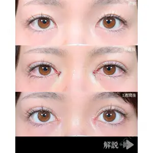 東京シンデレラ美容外科 池袋院 石井 達也医師の症例