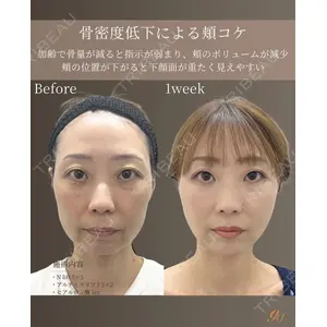 gift clinic 能登谷 翔医師の症例