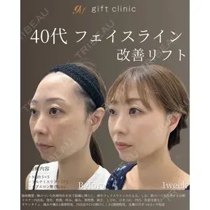 gift clinic 能登谷 翔医師の症例
