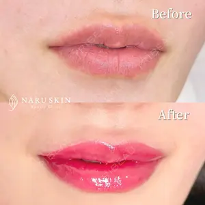 NARU Beauty Clinic 【ナルクリ】の症例