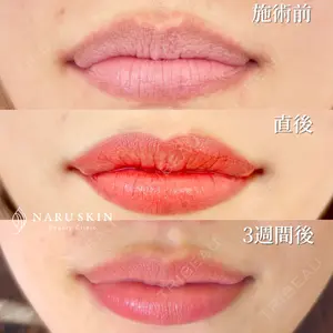 NARU Beauty Clinic 【ナルクリ】の症例