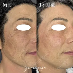 NARU Beauty Clinic 【ナルクリ】の症例