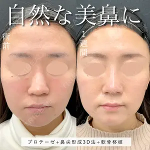 東京シンデレラ美容外科 池袋院 小出 真哉医師の症例
