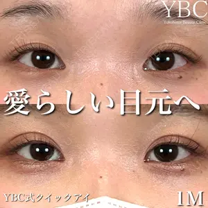 YBC横浜美容外科 池袋院 磯村 亮輔医師の症例