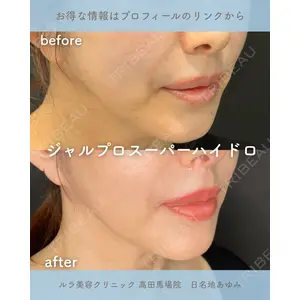 ルラ美容クリニック 高田馬場院 日名地 あゆみ医師の症例
