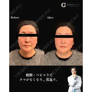 銀座美容クリニック 京都院 廣瀬 真也医師の症例