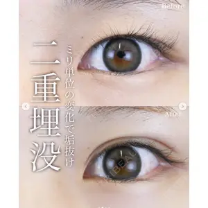 湘南美容クリニック 名古屋駅本院 高川 裕也医師の症例