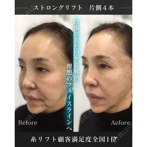 銀座美容クリニック 京都院 廣瀬 真也医師の症例