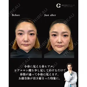 銀座美容クリニック 京都院 廣瀬 真也医師の症例