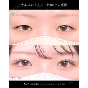 東京シンデレラ美容外科 大宮院 竹田 昌平医師の症例
