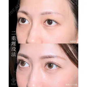 藤・ナチュレ美容クリニック 銀座院 小川 杏平医師の症例