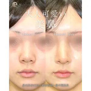 eクリニック 福岡院 伊藤 渉医師の症例