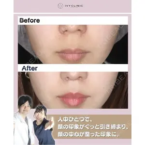 吉祥寺アイビークリニック 升本 浩紀医師の症例