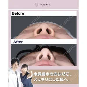 吉祥寺アイビークリニック 升本 浩紀医師の症例