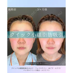 ルラ美容クリニック 札幌本院 佐藤 雄紀医師の症例