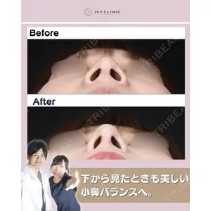 吉祥寺アイビークリニック 升本 浩紀医師の症例