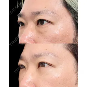 gift clinic 能登谷 翔医師の症例