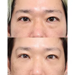 gift clinic 能登谷 翔医師の症例