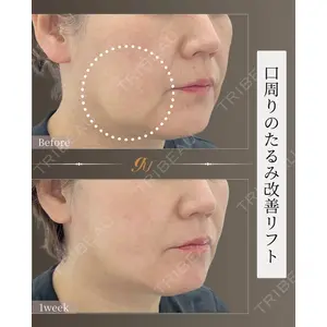 gift clinic 能登谷 翔医師の症例