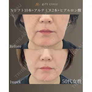 gift clinic 能登谷 翔医師の症例