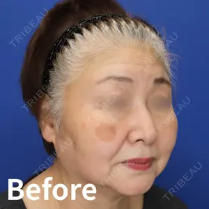 Kinshicho Beauty Clinic （錦糸町ビューティークリニック）の症例