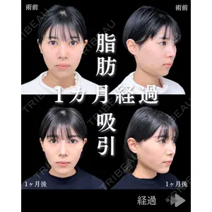 東京シンデレラ美容外科 池袋院 石井 達也医師の症例