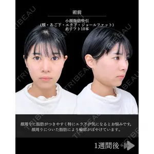 東京シンデレラ美容外科 池袋院 石井 達也医師の症例