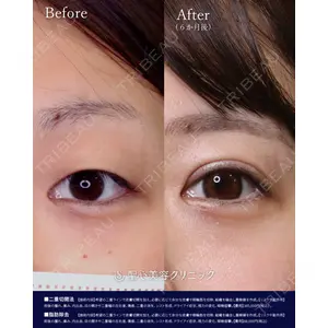 聖心美容クリニック 横浜院 佐々木 直美医師の症例