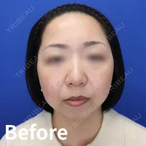 Kinshicho Beauty Clinic （錦糸町ビューティークリニック）の症例