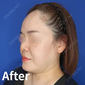 Kinshicho Beauty Clinic （錦糸町ビューティークリニック）の症例