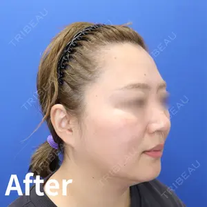 Kinshicho Beauty Clinic （錦糸町ビューティークリニック）の症例