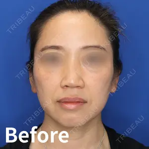 Kinshicho Beauty Clinic （錦糸町ビューティークリニック）の症例