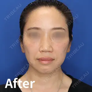 Kinshicho Beauty Clinic （錦糸町ビューティークリニック）の症例