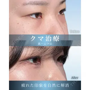 eクリニック 横浜みなとみらい院 坂本 優衣医師の症例