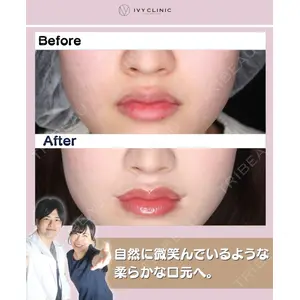 吉祥寺アイビークリニック 升本 浩紀医師の症例