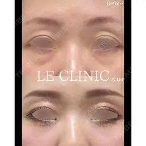 LE CLINICの症例
