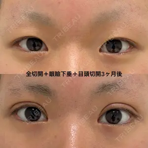 エターナル美容クリニックの症例
