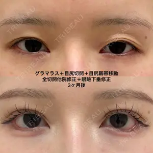 エターナル美容クリニック 久門田 詳医師の症例