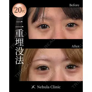 愛知春日井美容外科ネビュラクリニック 都築 諒医師の症例