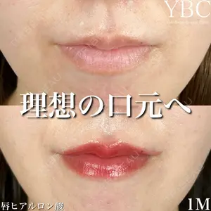 YBC横浜美容外科 池袋院 磯村 亮輔医師の症例