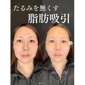 ルラ美容クリニック 上野院 沖津 勇気医師の症例